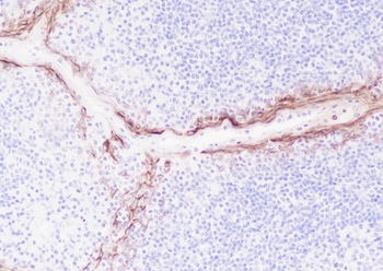 LYPD3 antibody