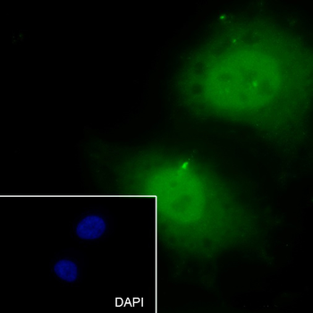 Caldesmon antibody