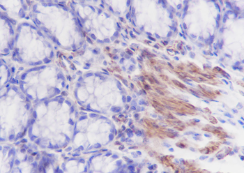 Caldesmon antibody