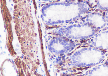 Caldesmon antibody