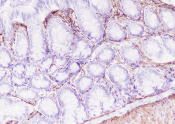 Caldesmon antibody