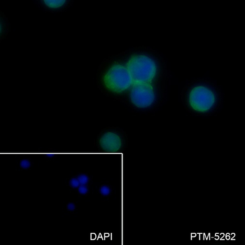 HLA-DPA1 antibody