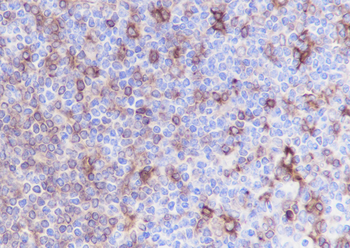 HLA-DPA1 antibody