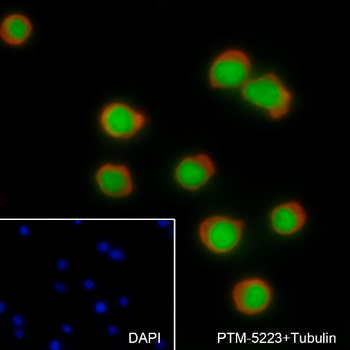 IKZF1 antibody