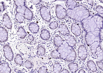 phospho-GSK-3 Beta (Ser9) antibody