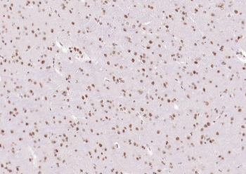 phospho-GSK-3 Beta (Ser9) antibody