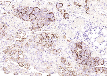 Mesothelin antibody