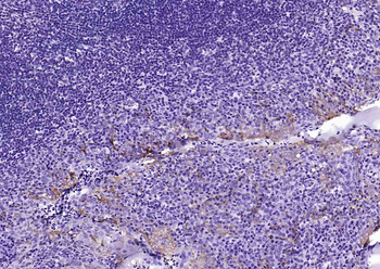 Mesothelin antibody