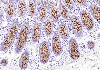 MUC2 antibody