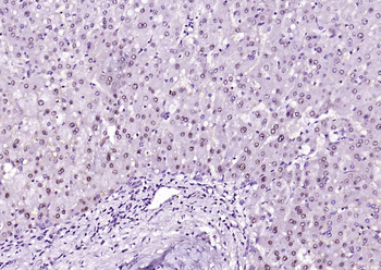 Arginase 1 antibody