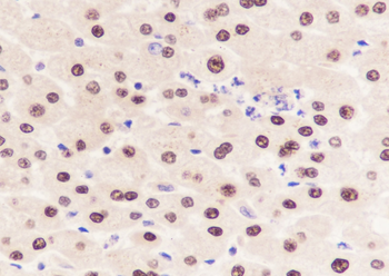 Arginase 1 antibody