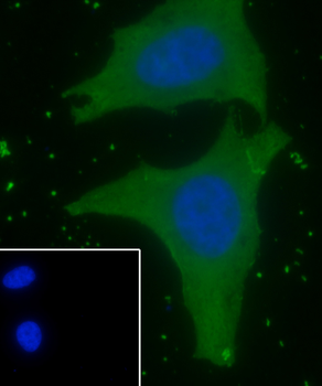 WNT10B antibody