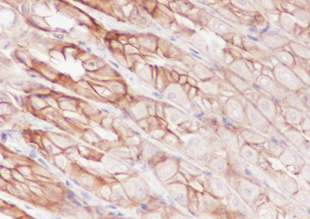 FGFR2 antibody