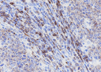 CD22 antibody