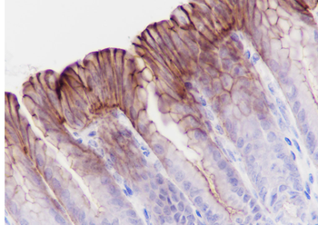 phospho-Girdin (Tyr1765) antibody