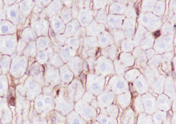 phospho-Girdin (Tyr1765) antibody