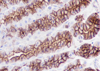 phospho-Girdin (Tyr1765) antibody