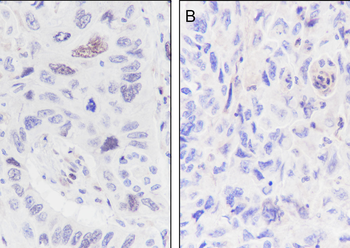 Ubiquityl-Histone H2B (Lys120) antibody