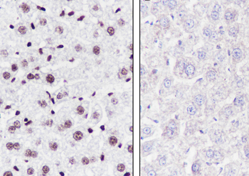 Ubiquityl-Histone H2B (Lys120) antibody