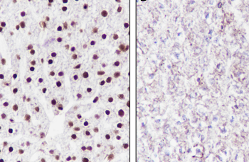 Ubiquityl-Histone H2B (Lys120) antibody