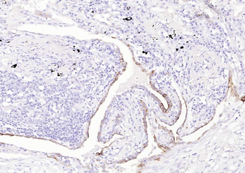 MUC-4 antibody