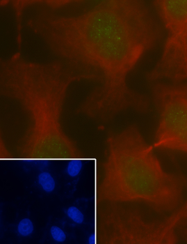 MSH2 antibody