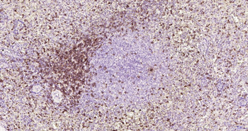 CD7 antibody