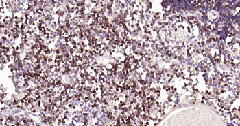 CD7 antibody