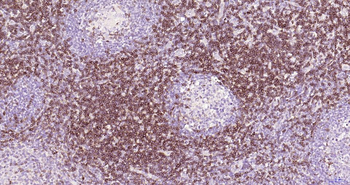 CD7 antibody