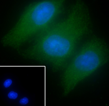 Aurora B antibody