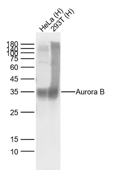 Aurora B antibody