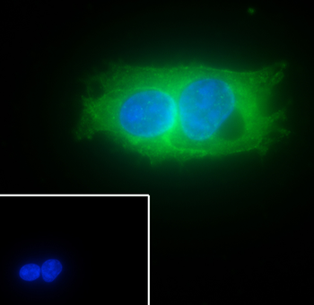 Glypican 3 antibody