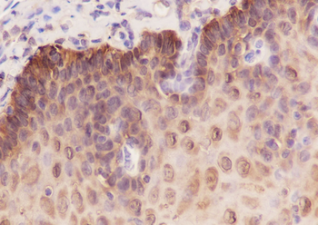 14-3-3 sigma antibody