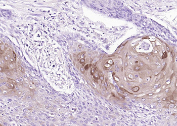 ALDH1A1 antibody