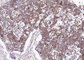 ALDH1A1 antibody