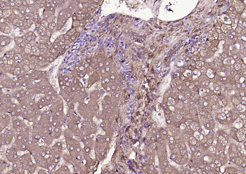 ALDH1A1 antibody