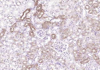 ALDH1A1 antibody