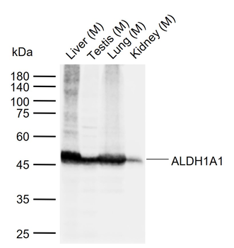 ALDH1A1 antibody