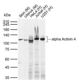 alpha Actinin 4 antibody