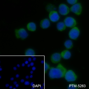 HLA-DPB1 antibody