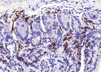 JCHAIN antibody