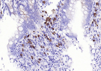 JCHAIN antibody