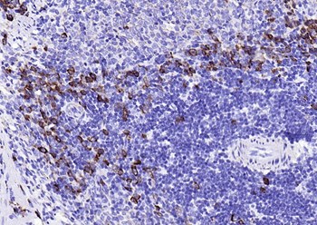 JCHAIN antibody