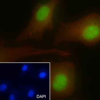 P14ARF antibody