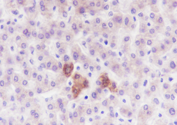 PDPK1 antibody