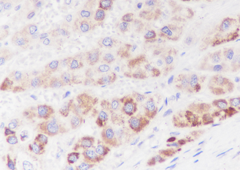 PDPK1 antibody