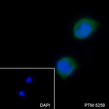 URI1 antibody