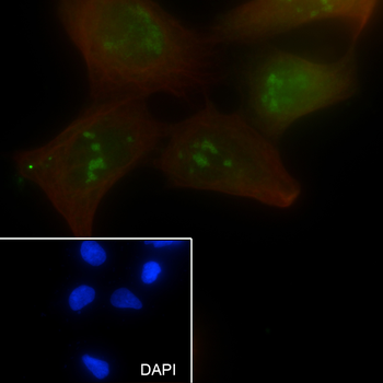 AATF antibody