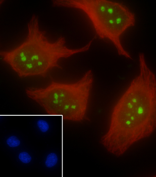 AATF antibody