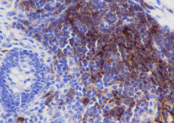 CD35 antibody